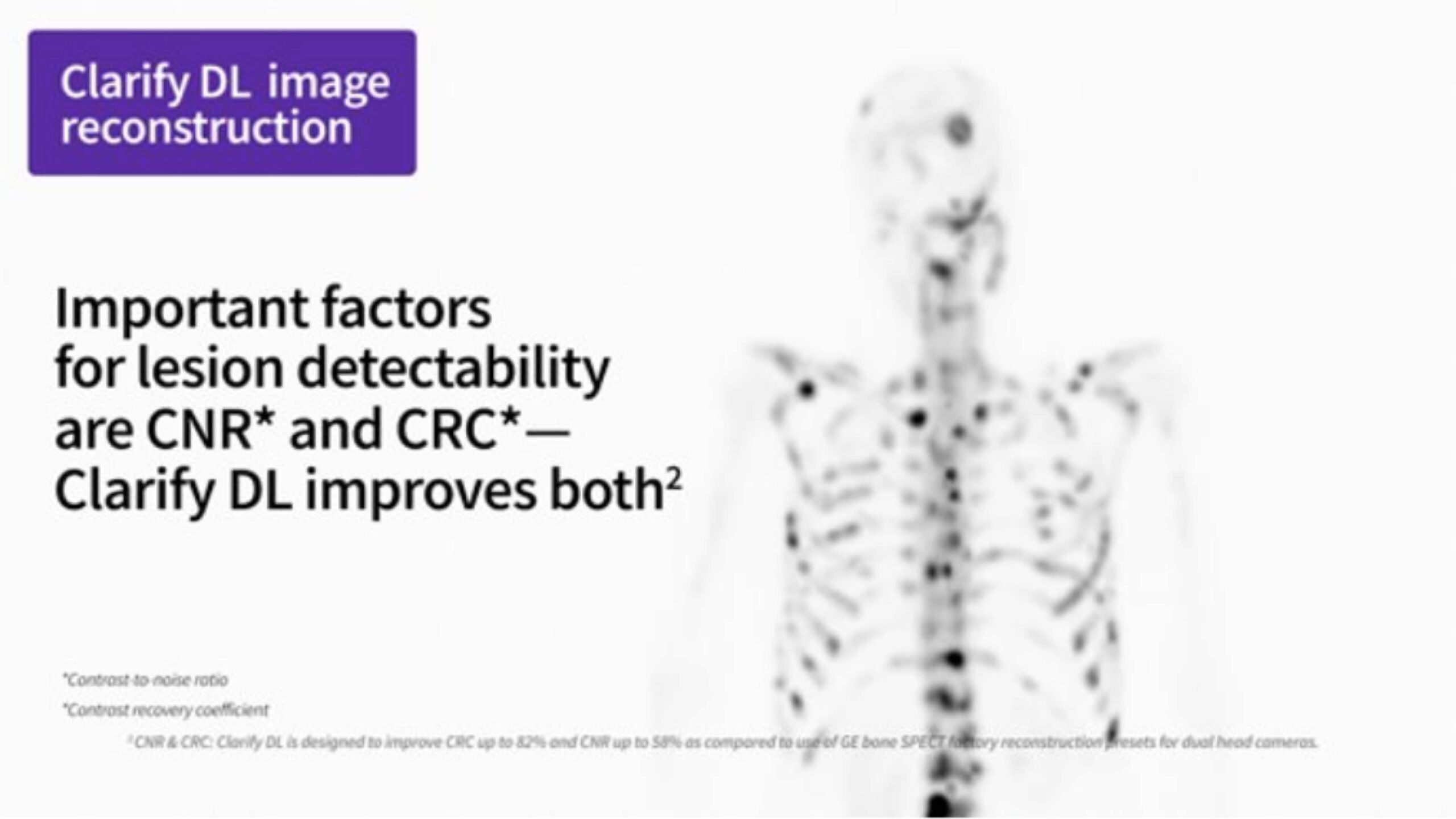 clarify-dl-lesion-detectability-spect-scan